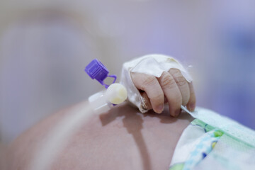 Closeup lovely little newborn baby infant lying in incubators for newborns, Newborn baby having the the breathing problem after birth, newborn in NICU, Neonatal intensive care unit.