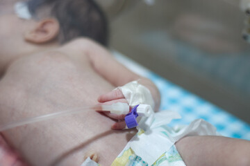 Closeup lovely little newborn baby infant lying in incubators for newborns, Newborn baby having the the breathing problem after birth, newborn in NICU, Neonatal intensive care unit.