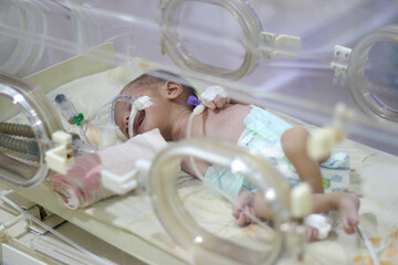 Closeup lovely little newborn baby infant lying in incubators for newborns, Newborn baby having the the breathing problem after birth, newborn in NICU, Neonatal intensive care unit.
