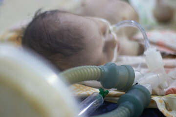 Closeup lovely little newborn baby infant lying in incubators for newborns, Newborn baby having the the breathing problem after birth, newborn in NICU, Neonatal intensive care unit.