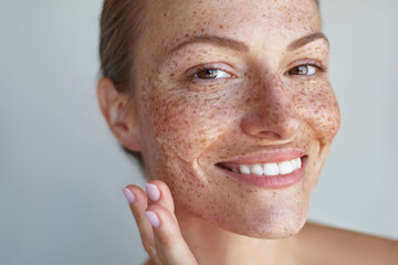 Smiling woman with freckles and radiant hydrated skin, gently applying skincare soothing gel on her face, showcasing natural beauty in a close-up shot against a light background.