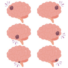 腫瘍がある脳のイラスト　横視点