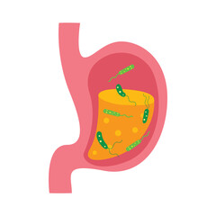 vibrio cholera bacteria infection disease concept