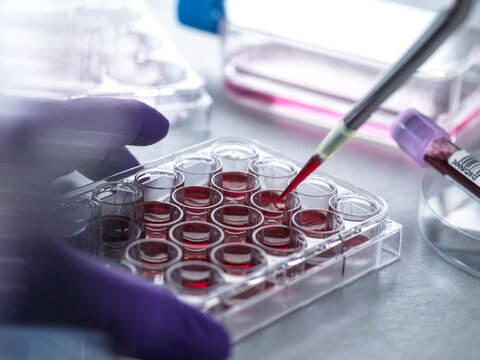 Cell Research, Scientist pipetting blood for cell research during a clinical trail in the lab