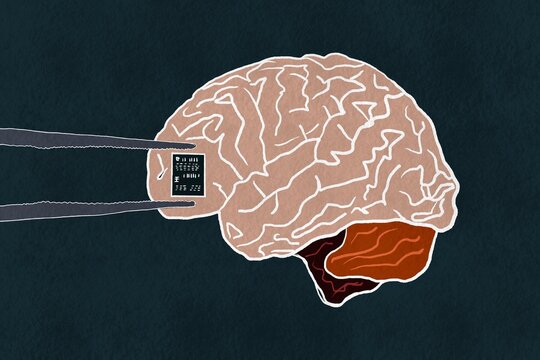Illustration of a brain with microchip installation concept technology