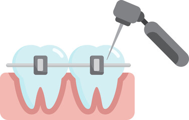 braces cleaning tooth teeth drill tool