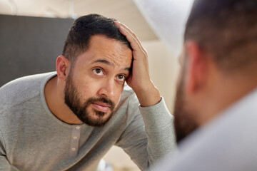 Mid adult multiethnic man worried about hair loss
