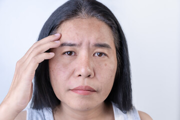 Woman with a thoughtful expression and worries about the wrinkles on her face touched her forehead...