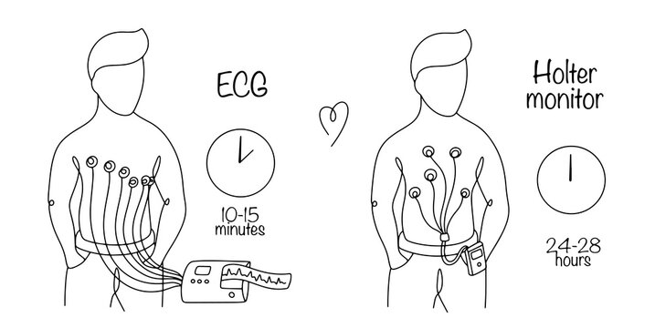 ECG and Holter monitor