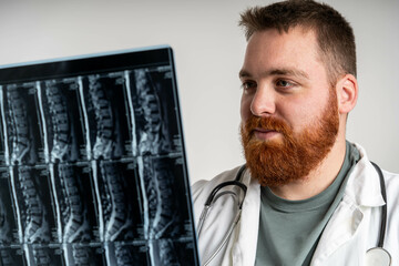Neurologist and surgeon examine a patient's spine image. Radiologist doctor examining spinal column...