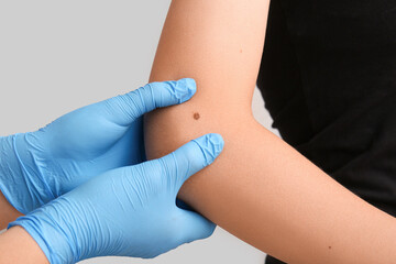 Dermatologist examining moles of young woman on grey background