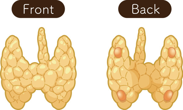 甲状腺、副甲状腺のイラスト Thyroid Gland , Parathyroid glands illustration