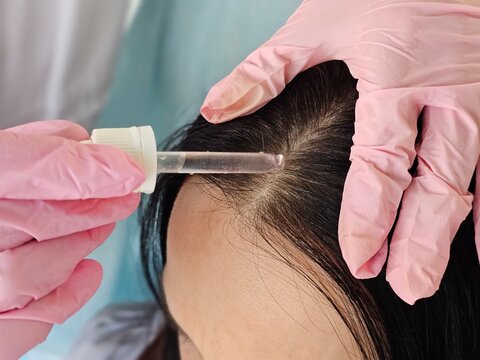 Scalp treatment session with focus on hair rejuvenation techniques in a clinical setting