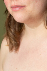 Close-up of curvy woman with clear skin imperfections