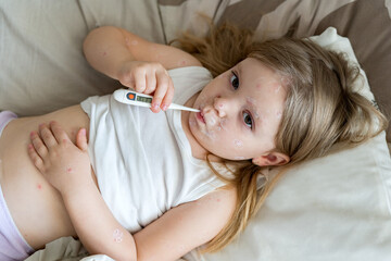 Fever, viral disease in a child. Girl lying in bed with chickenpox rash with thermometer