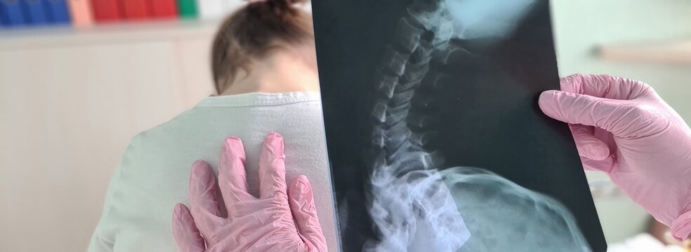 Pediatrician doctor examines x-ray of child spinal deformity