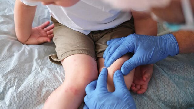 Doctor examining child with bodily red rash. Kid allergy closeup. Little baby scratches an eruption. Nurse applies special cream to atopic skin. Dermatitis, irritation, hive. Pruritus. Mosquito bites