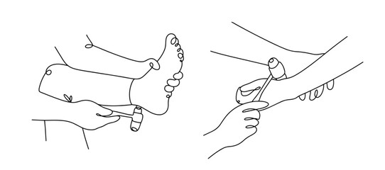 Neurology. Reflex test