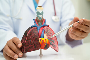Pneumonia, lung cancer, Asian doctor holding human anatomy model for study diagnosis and treatment...