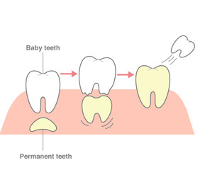 The process where permanent teeth push through and replace baby teeth by dissolving them.