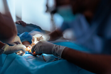 Doctors Performing Hand Surgery in orthopedics Clinic. Medical personnel using a retractor for...