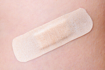 Closeup view of a covered wound with an adhesive plaster