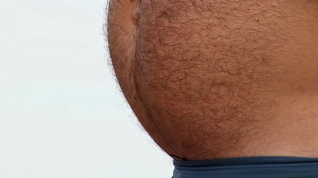 Big bare hairy belly, obesity due to calorie surplus from poor unbalanced diet. Frequent consumption of fastfood beer has resulted in nutritional imbalance harmful health risks. Excess fat Cholesterol