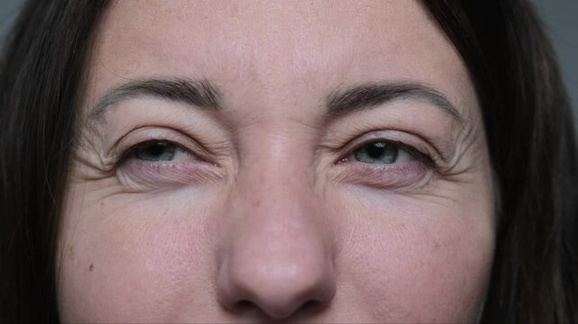 Close up of girl's eyes squinting showing facial wrinkles