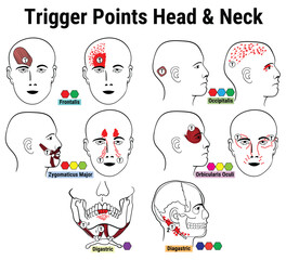 Head and Neck trigger points vector Diagram