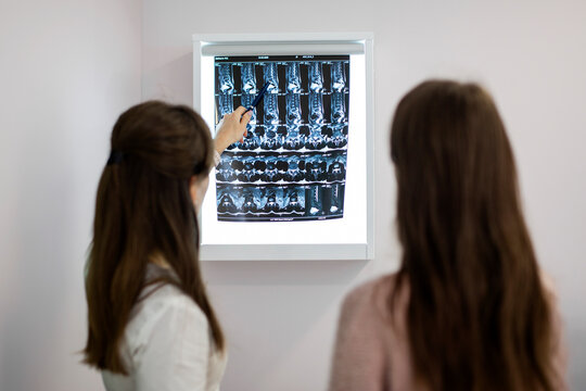Two women are looking at a medical image x-ray of a woman's chest