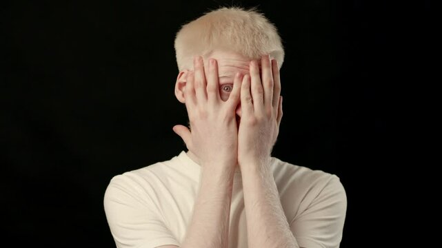 A young man with albinism has white skin and hair, covering his face with both hands. He is likely feeling shy or introspective, standing against a dark backdrop.
