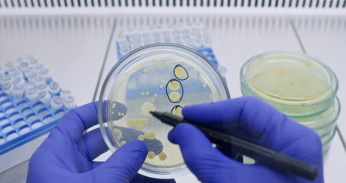 A scientist circles bacterial colonies in a petri dish with a black marker while conducting research in a lab.