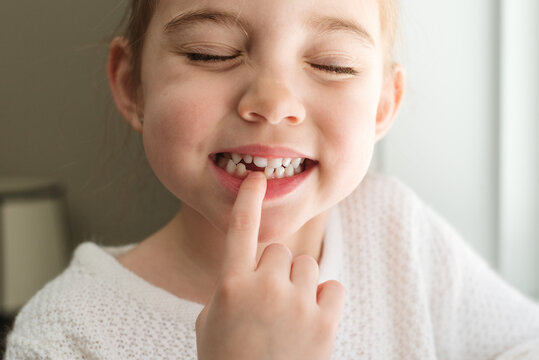 Happy little girl points to where she lost first baby tooth