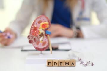 A detailed kidney model highlighting edema aspects, vital for medical education and public awareness