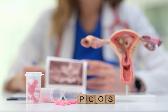 Explore PCOS complexities with visual aids and expert analysis for better understanding of the condition
