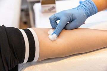 Doctor or nurse taking a blood sample from arm vein with a vacutainer. Venipuncture or venepuncture...