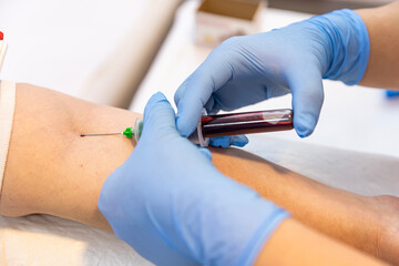 Doctor or nurse taking a blood sample from arm vein with a vacutainer. Venipuncture or venepuncture...