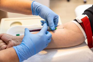 Doctor or nurse taking a blood sample from arm vein with a vacutainer. Venipuncture or venepuncture...