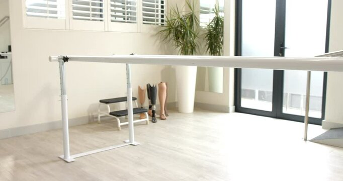 Prosthetic legs displayed in lab with parallel bars for rehabilitation therapy