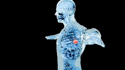 3D visualization of LUNG cancer, Medical Animation , X-Ray: A detailed medical image highlighting the evolution of LUNG cancer. on dark background
