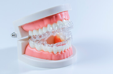 Close-up. Transparent aligners for artificial jaw teeth on a white background