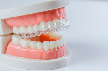Close-up. Transparent aligners for artificial jaw teeth on a white background