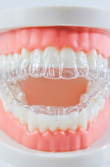 Close-up. Transparent aligners for artificial jaw teeth on a white background