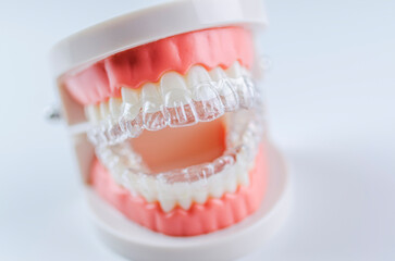 Invisible dental teeth brackets teeth aligners on blue background. Plastic braces dentistry retainers to straighten teeth on a white background