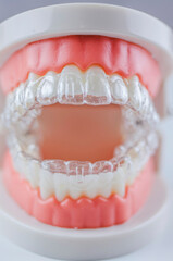 Close-up. Transparent aligners are placed over the teeth of an artificial jaw.