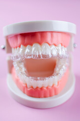 Close-up. Transparent aligners for artificial jaw teeth on a pink background