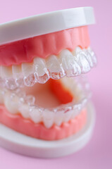 Invisible dental teeth brackets teeth aligners on blue background. Plastic braces dentistry retainers to straighten teeth on a pink background