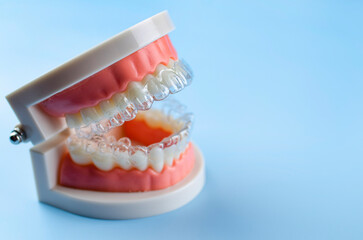 Close-up. Transparent aligners for artificial jaw teeth on a blue background