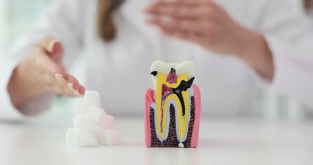 Model of tooth with cavities and sugar cubes placed on table. Dentist explains harmful effects of sugary snacks on dental health. Slow motion