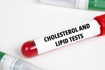Cholesterol and lipid tests title text of medical analysis